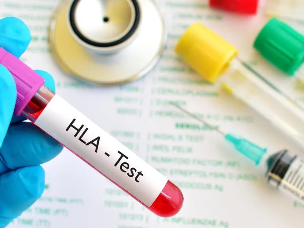 Re-analysing the effect of HLA matching on blood or marrow transplantation