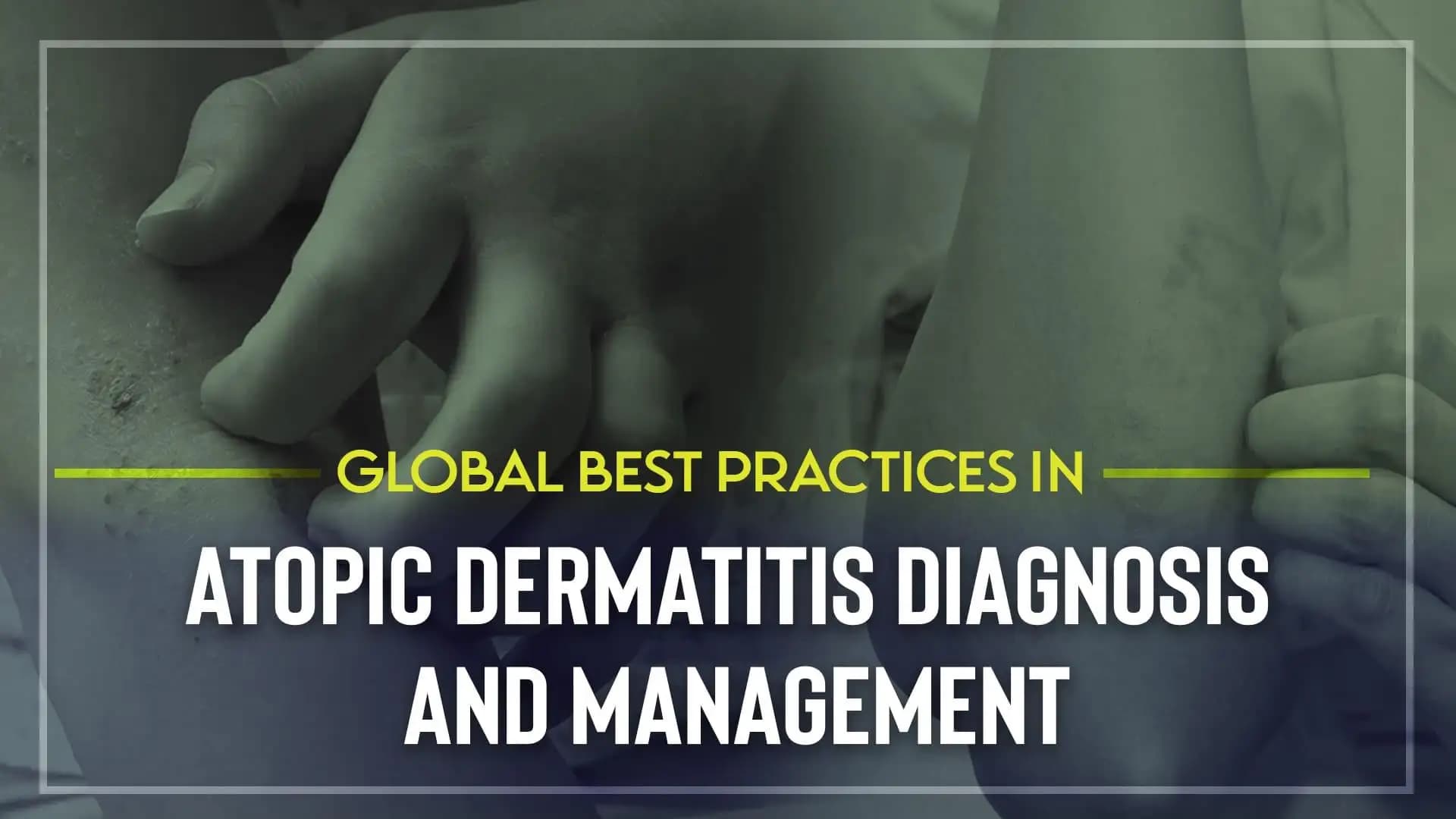 Global Best Practices in Atopic Dermatitis Diagnosis and Management