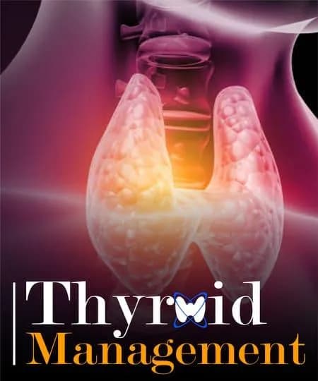 Thyroid Management