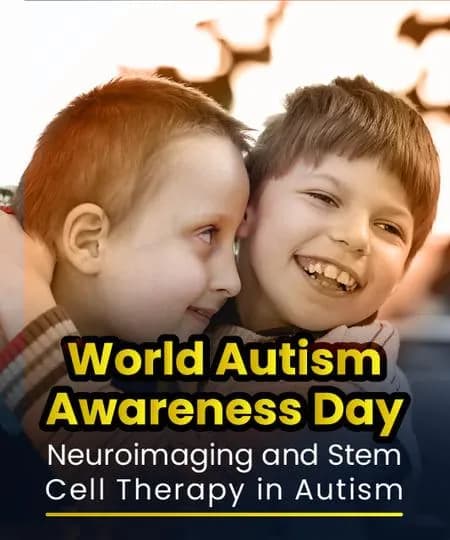 World Autism Awareness Day | Neuroimaging and Stem Cell Therapy in Autism