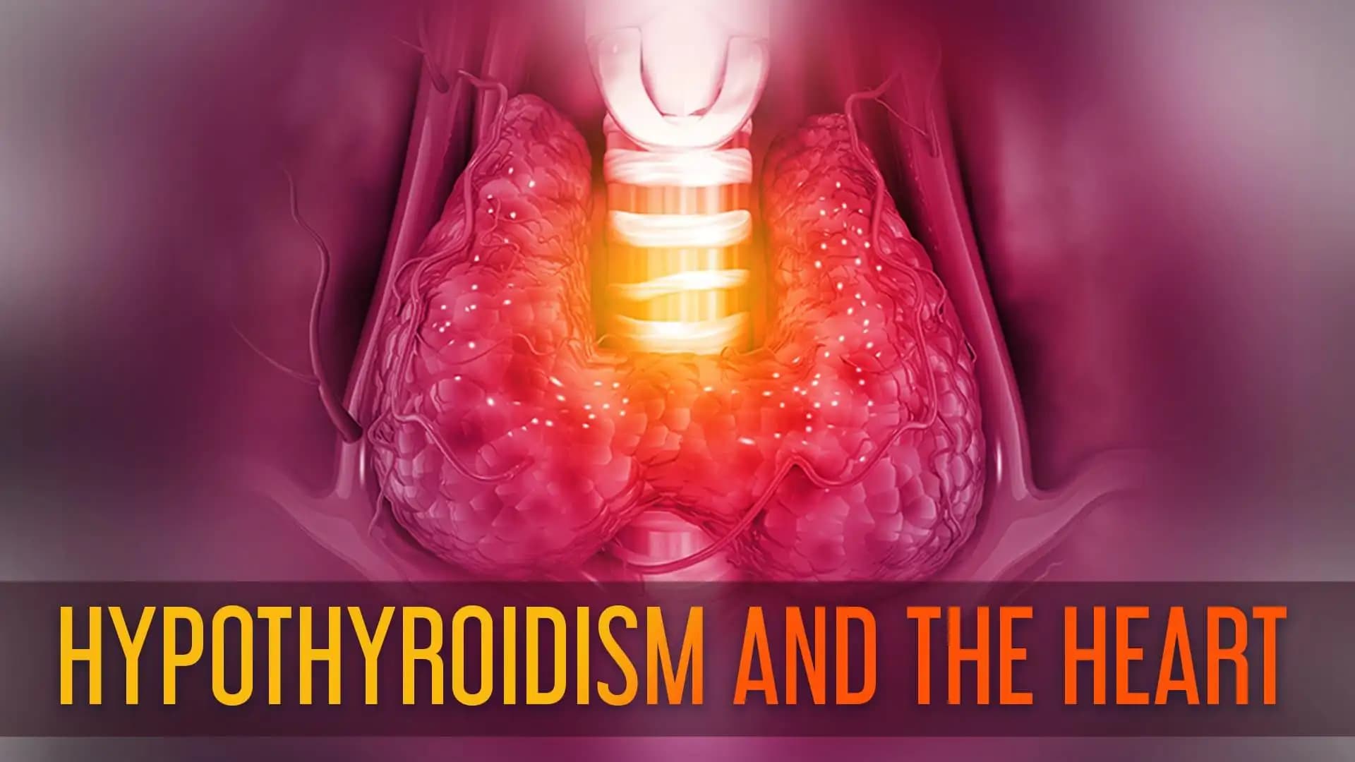 Hypothyroidism and the Heart