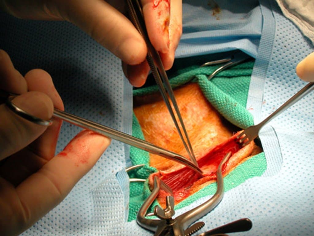 Ultrasound measures of IVC in predicting IH during vascular surgery