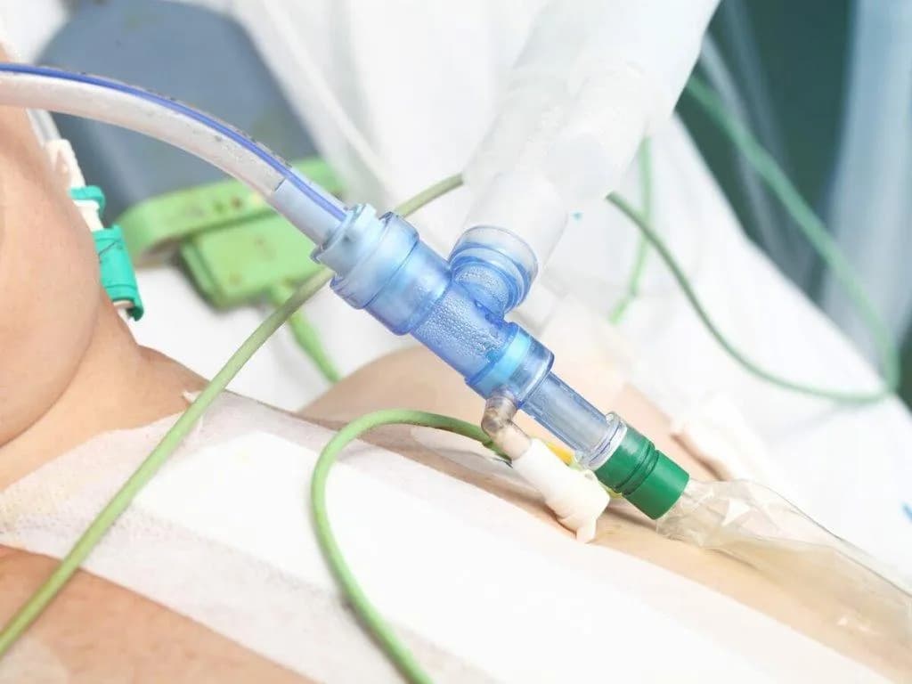 Frequency of extubation recall in remimazolam anaesthesia and flumazenil