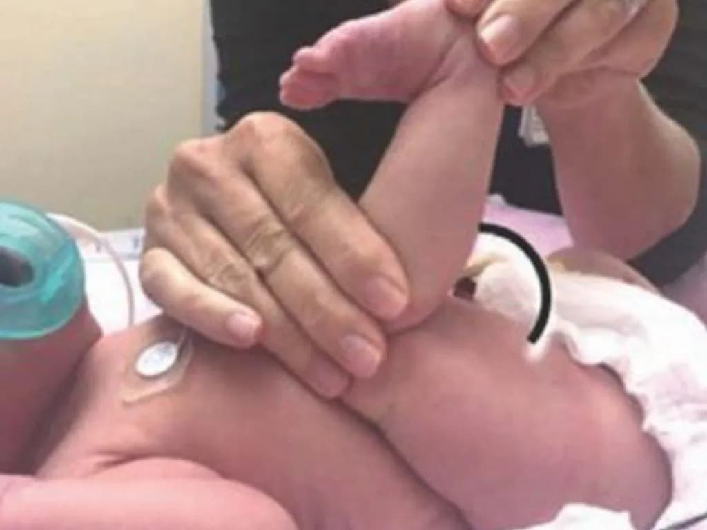 Extremely preterm infants show a lag in the neurobehavioral profile