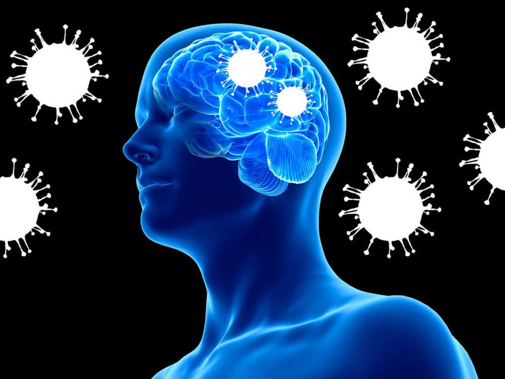 Cognitive decline after mild SARS-CoV-2 infection: EEG evidence